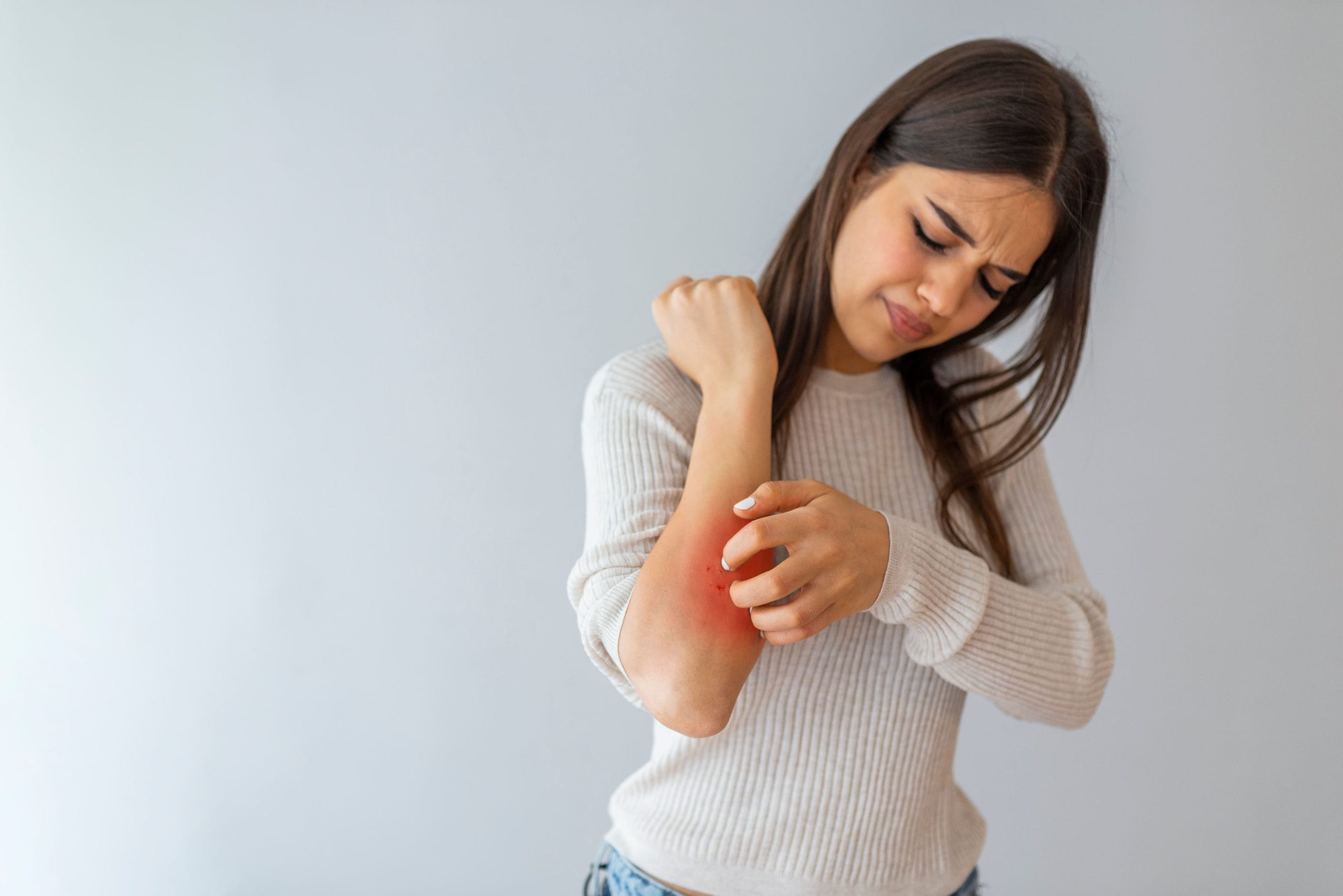 Blogs 2 How is Psoriasis Treated